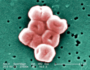 Imagen: Microfotografía electrónica de barrido (SEM) de Acinetobacter baumannii (Fotografía cortesía de Janice Haney Carr).